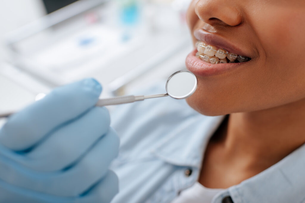 tips for selecting an orthodontist