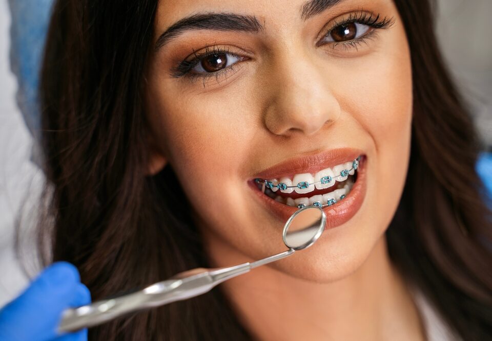 Answering Your Most Common Orthodontic Questions