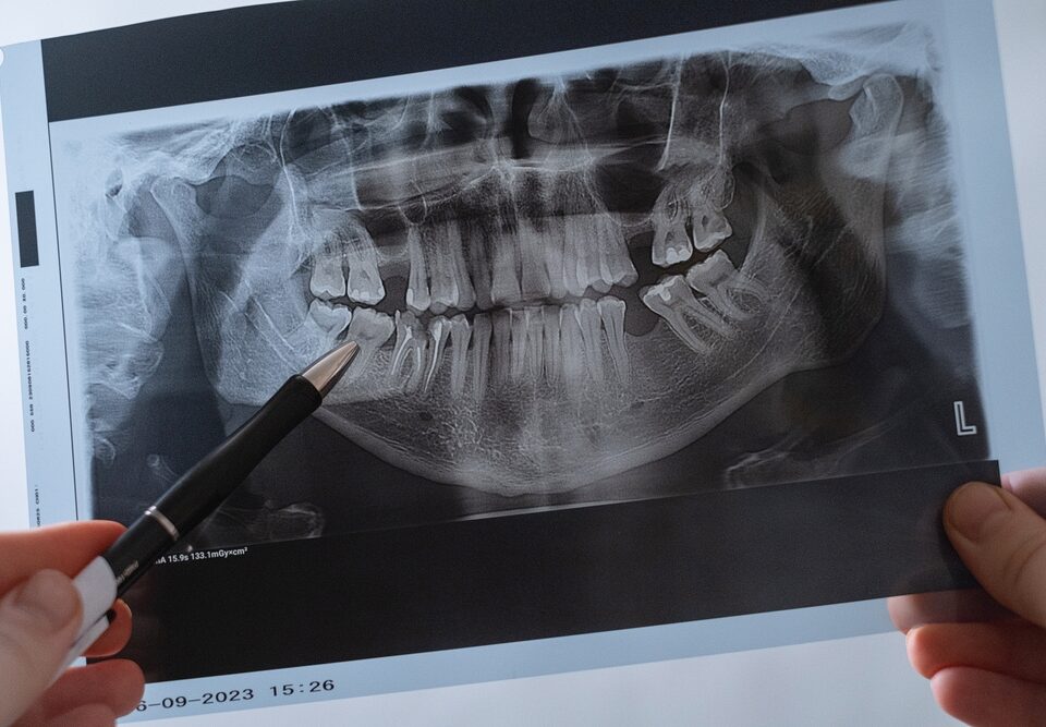 Can Orthodontic Treatment Help You Sleep Better?