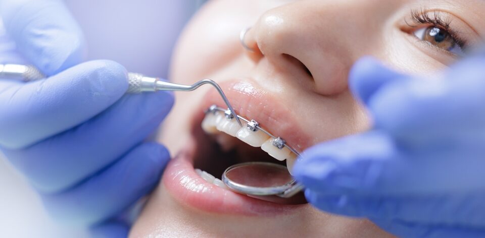 Do I Need an Orthodontist or a Dentist? Understanding the Difference